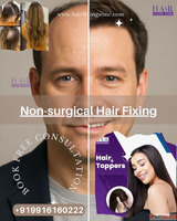 Balding Don't worry - fix it instantly