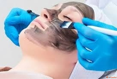 Carbon Peel in Gurgaon Benefits Procedure Results at Citrine Clinic