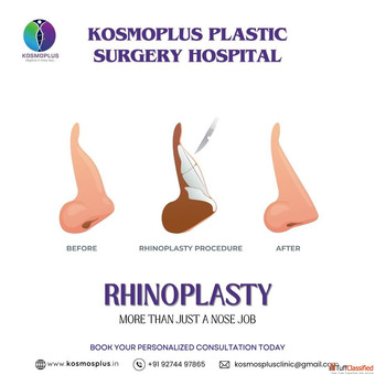Top Clinic for Rhinoplasty in Ahmedabad with High Success Rates