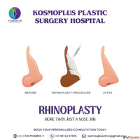 Top Clinic for Rhinoplasty in Ahmedabad with High Success Ra...