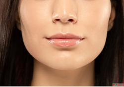 Lip Peel Treatment in Gurgaon Best Dermatologist in Gurgaon