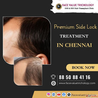 Best Advanced Scalp Micropigmentation Clinic in Chennai
