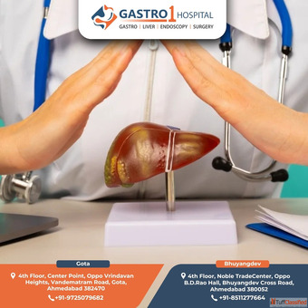 Gastro1 Hospital - Leading Center for Liver Transplant in Ahmedabad
