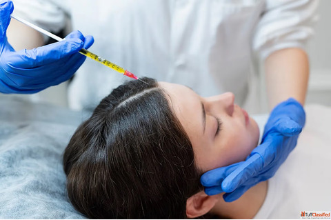 Hair loss treatment cost in India - Dermapuritys