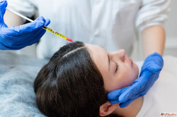 Hair loss treatment cost in India - Dermapuritys