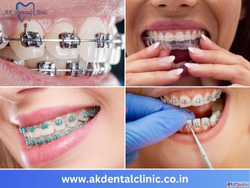 Best Dentist in Vile Parle West Mumbai AK Dental Clinic