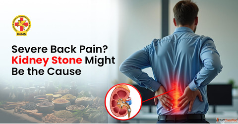 Severe Back Pain Kidney Stone Might Be the Cause