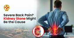 Severe Back Pain Kidney Stone Might Be the Cause