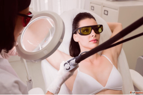Permanent Laser Hair Removal in Bangalore - Smooth Silky Skin