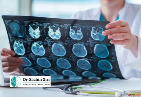 Brain Tumor Surgery in Mumbai by Dr.Sachin Giri