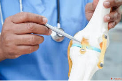 Best Joint Replacement Surgeon in India from Saviour Hospita...