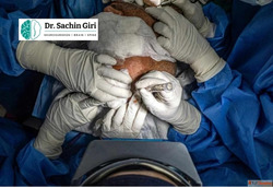 Skull Base Surgery in Mumbai by Dr.Sachin Giri