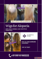 What Makes Alopecia Wigs in Bangalore So Popular