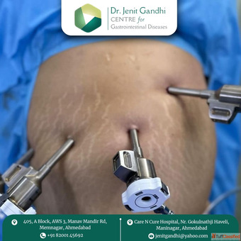 Get Expert Laparoscopic Surgical Care in Ahmedabad by Dr. Jenit Gandhi