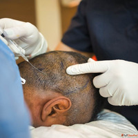 Trusted Clinic for Hair Transplant and PRP Treatment in Mumb...