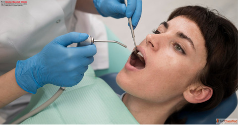 Tooth Filling in Indore Teeth Restoration in Indore Smile Dental Clinic - Dr Ashish Jain 