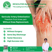 Genicular Anastomosis Treatment by Dr. Sandeep Sharma IR Fac...