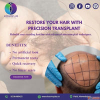 Premium Hair Transplant in Ahmedabad with Latest Technology