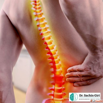 Dr.Sachin Giri - Best Spine Surgeon in Mumbai