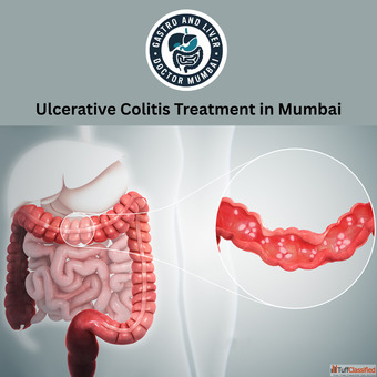 Dr. Harshad Joshi - Top Gastroenterologist Offering Ulcerative Colitis Treatment in Mumbai