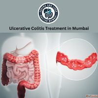Dr. Harshad Joshi - Top Gastroenterologist Offering Ulcerati...