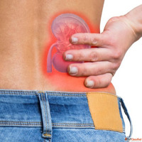 Consult Dr. Chandan Chaudhari for the Best Kidney Stone Trea...