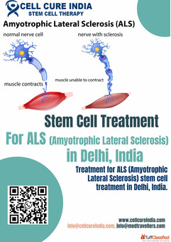 Stem Cell Treatment for ALS in India