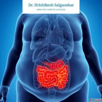 Advanced Weight Loss Care by the Best Obesity Surgeon in Mum...