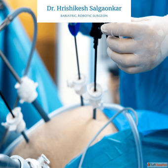 Highly Experienced Bariatric Surgeon in Mumbai India for Safe Weight Loss