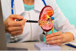 Best Kidney Transplant in Mumbai for Long-Term Kidney Health...