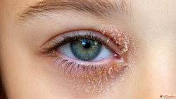 Trusted Eye Care Solutions in Chembur - Expert Vision Treatm...