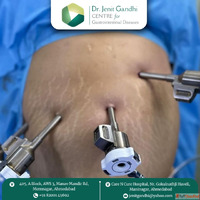 Advanced Robotic Hernia Surgeon in Ahmedabad - Dr. Jenit Gan...