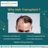 Book Hair Transplant Surgery in Ahmedabad - Phoenix Cosmetic