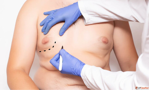 Cosmetic Surgery for Men What's Trending Right Now