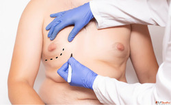 Cosmetic Surgery for Men What's Trending Right Now