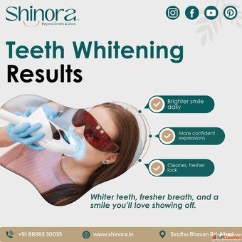 Shinora Clinic - Best Teeth Whitening in Ahmedabad