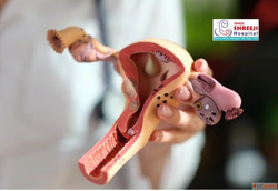 Shree Shreeji Womens Hospital - Best Ovarian Cyst Treatment ...