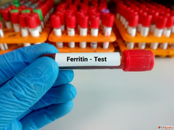 Screen for Iron Deficiency - Book Ferritin Test Online