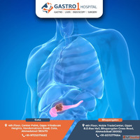 Advanced Treatment for Acute Pancreatitis in Ahmedabad - Gas...