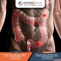 Trusted Colon Cancer Treatment in Ahmedabad by Gastro1 Hospi...