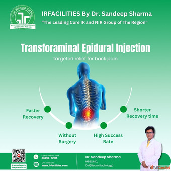 Spine Operation Cost in India Dr Sandeep Sharma