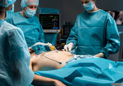 Modern Gastric Sleeve Procedure for Lasting Results