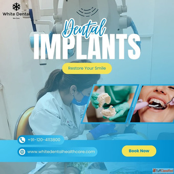 Dental implants in Indirapuram for long-lasting tooth replacement