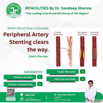 Peripheral Arterial Doppler Test for Accurate Diagnosis