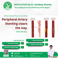 Peripheral Arterial Doppler Test for Accurate Diagnosis