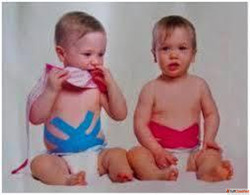 Expert Kinesio Taping in Gurgaon for Pediatric Rehabilitatio...