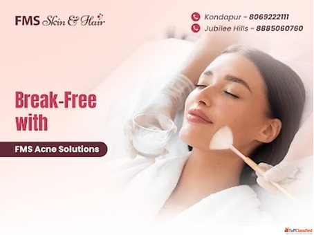 Best Acne treatment in Hyderabad