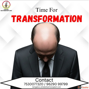 Hair transplant in Bengaluru
