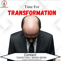 Hair transplant in Bengaluru