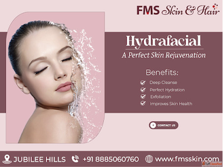 HydraFacial Treatment cost in Hyderabad